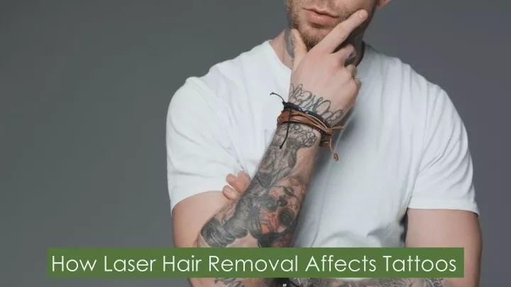 how laser hair removal affects tattoos