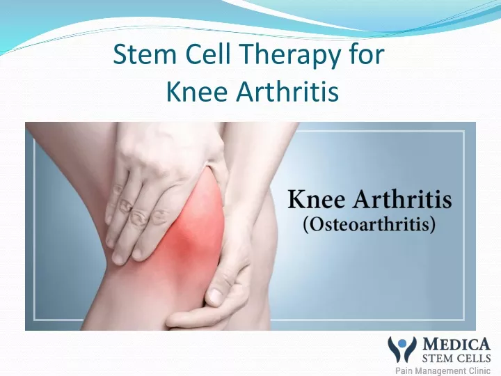 stem cell therapy for knee arthritis