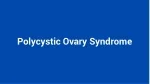 Polycystic Ovary Syndrome - slide 1