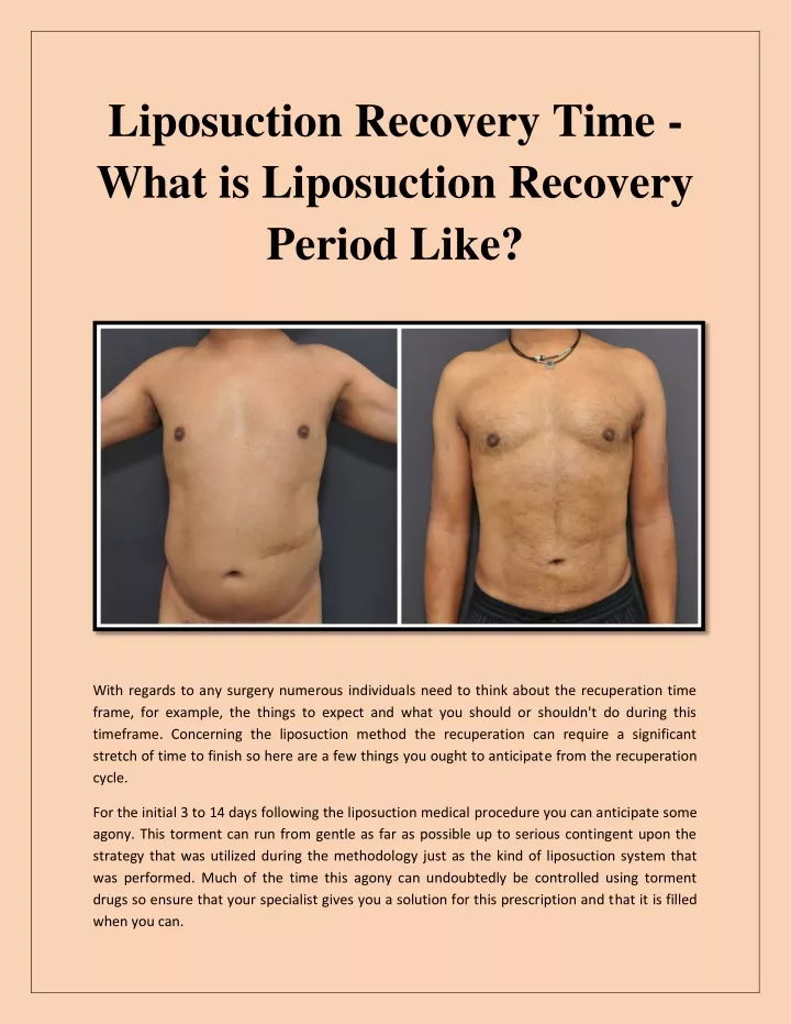liposuction recovery time what is liposuction
