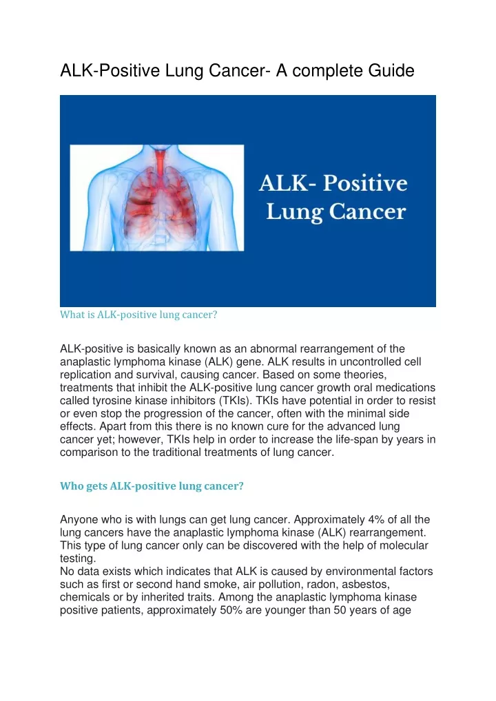 alk positive lung cancer a complete guide