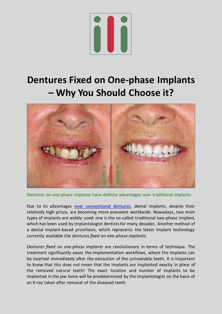 dentures fixed on one phase implants