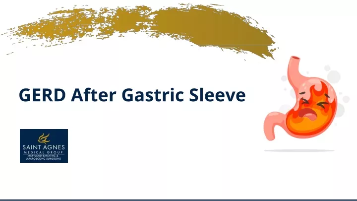 gerd after gastric sleeve