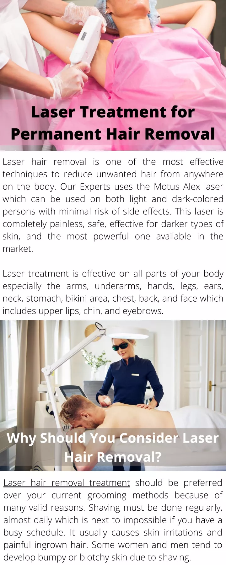 laser treatment for permanent hair removal