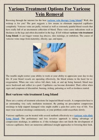 Various Treatment Options For Varicose Vein Removal