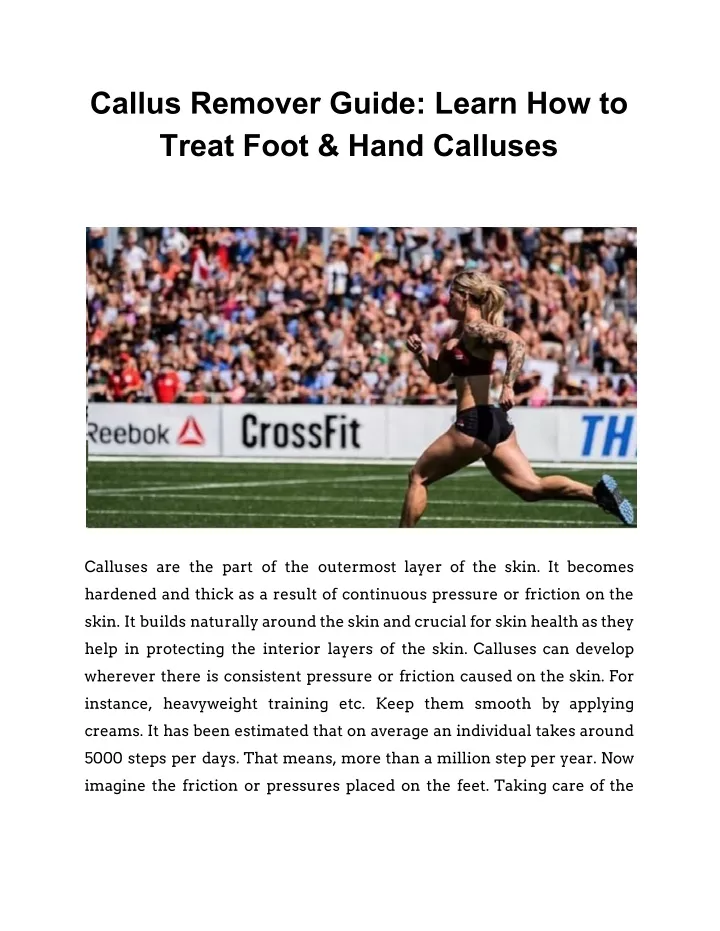 callus remover guide learn how to treat foot hand