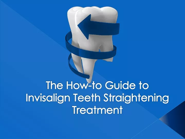 the how to guide to invisalign teeth straightening treatment