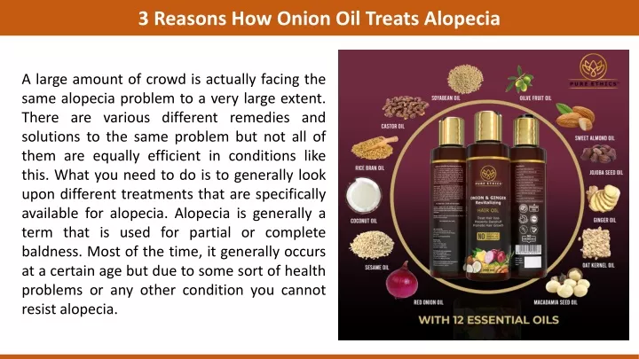 3 reasons how onion oil treats alopecia