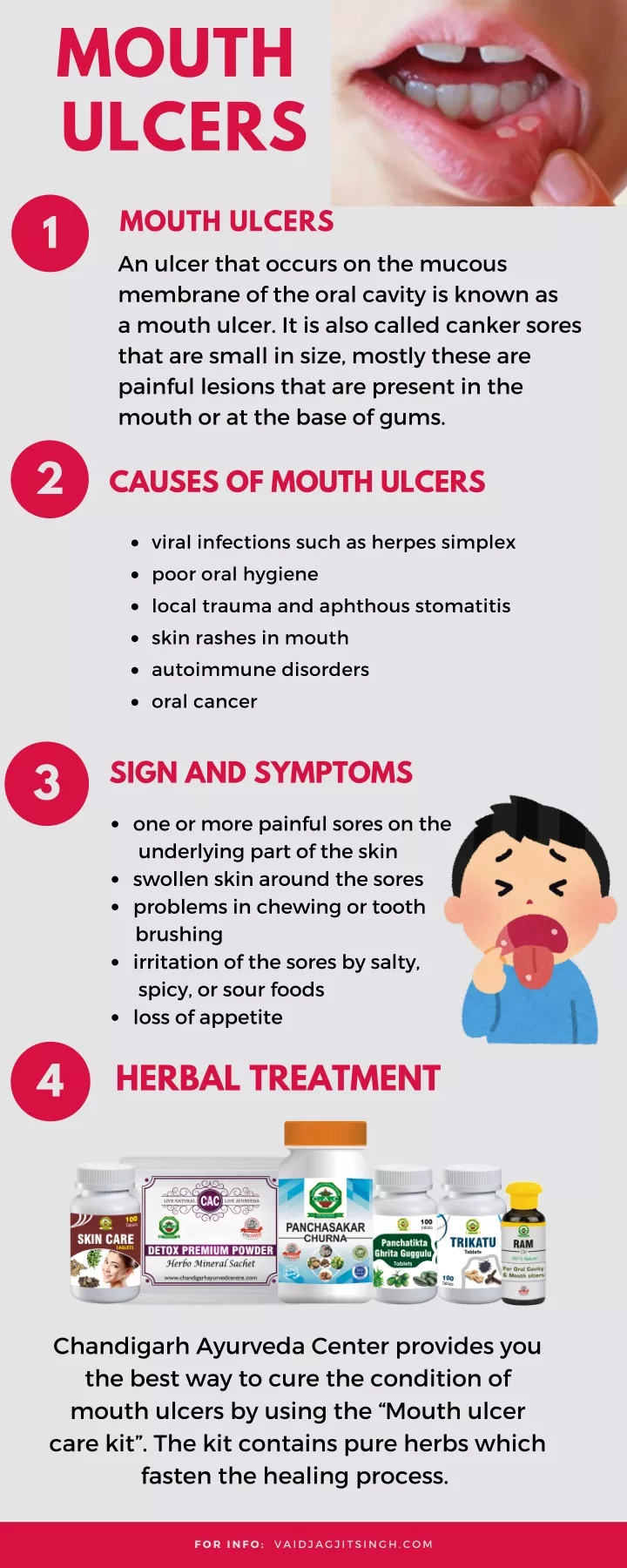 Ppt Mouth Ulcers Causes Symptoms And Herbal Treatment Powerpoint Presentation Id10121260 9581