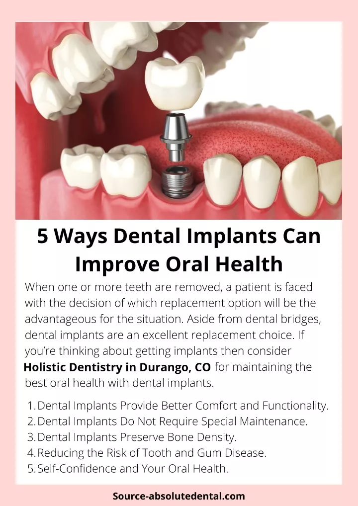 5 ways dental implants can improve oral health