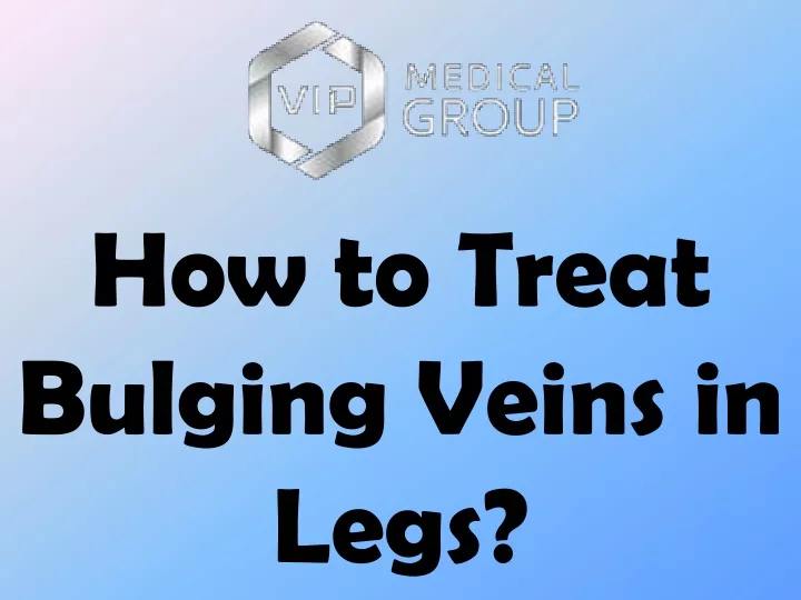 how to treat bulging veins in legs