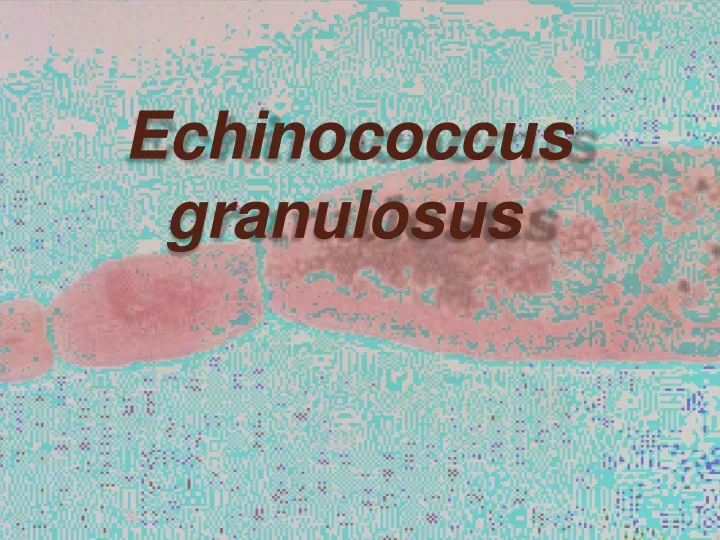 echinococcus granulosus