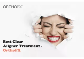 Best Clear Aligner Treatment | Teeth Alignment | Clear Aligners