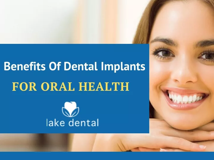 benefits of dental implants for oral health