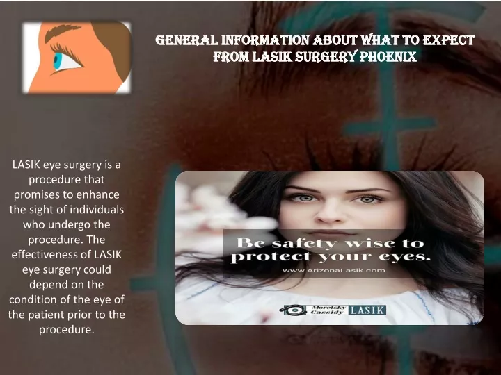 general information about what to expect from lasik surgery phoenix