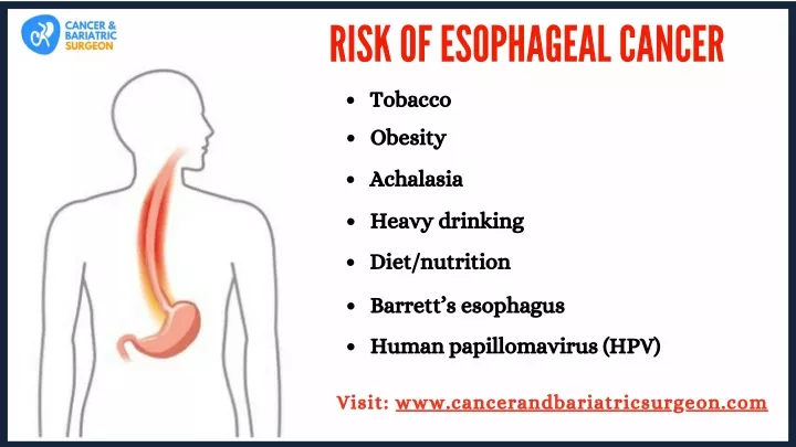 risk of esoph a ge a l c a ncer