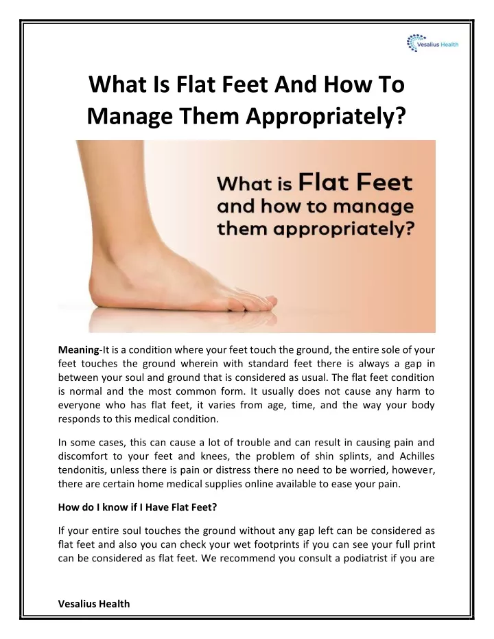 what is flat feet and how to manage them