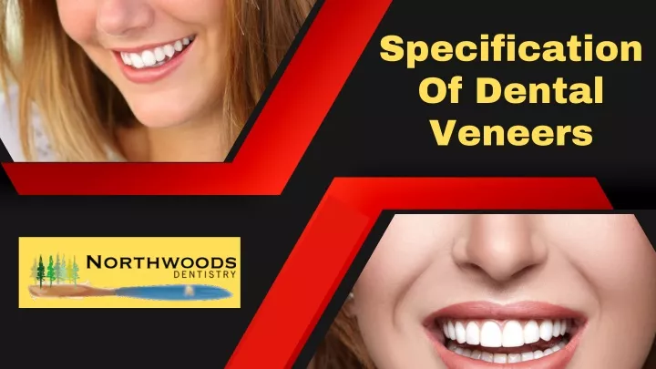 specification of dental veneers