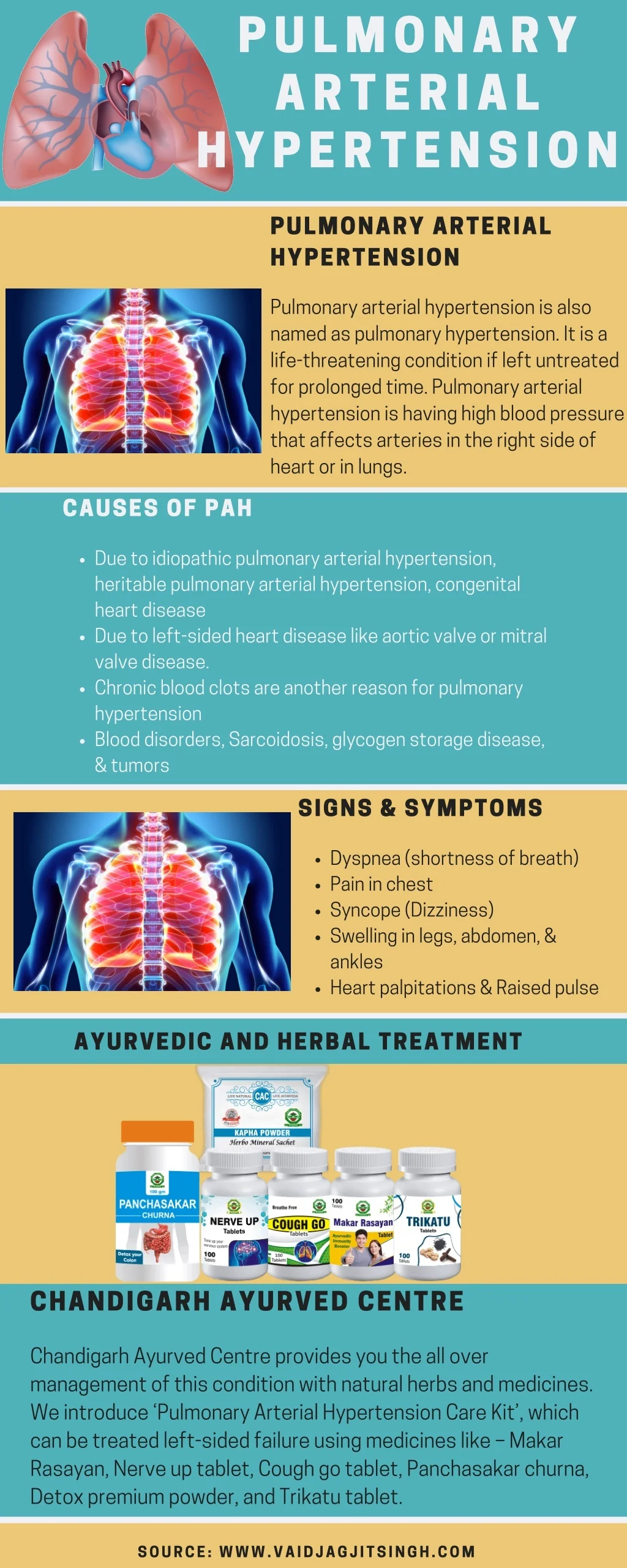 PPT - Pulmonary arterial hypertension - Herbal Treatment PowerPoint ...