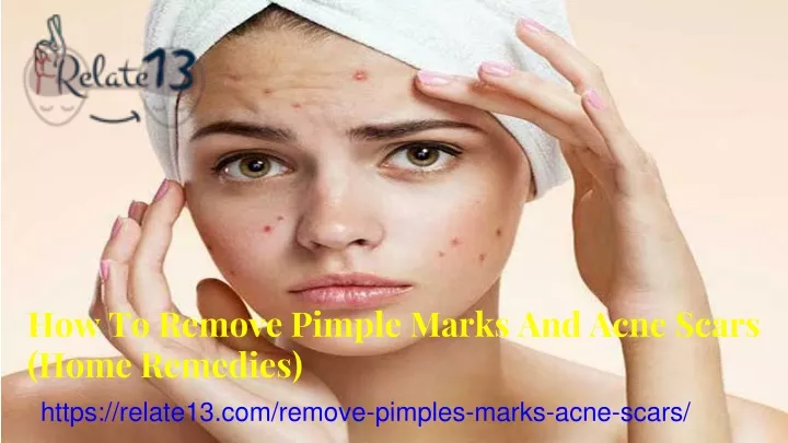 how to remove pimple marks and acne scars home remedies