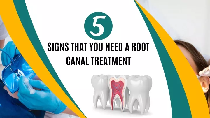 signs that you need a root canal treatment