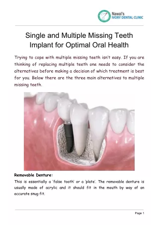 Single and Multiple Missing Teeth Implant for Optimal Oral Health