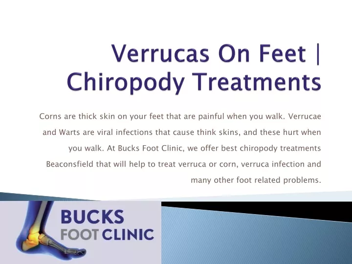 verrucas on feet chiropody treatments