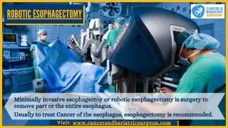 Robotic Esophagectomy | Best GI Cancer Surgeon in Bangalore