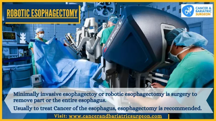robotic esoph a gectomy