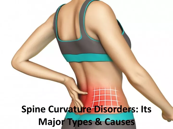 spine curvature disorders its major types causes