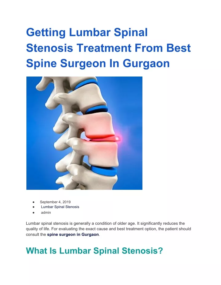 getting lumbar spinal stenosis treatment from