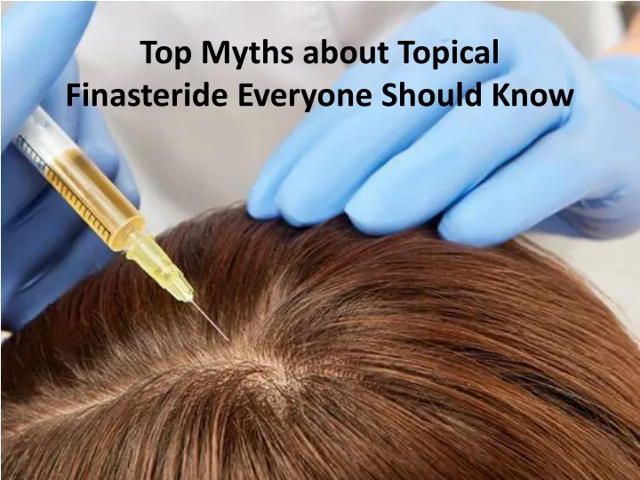 top myths about topical finasteride everyone should know
