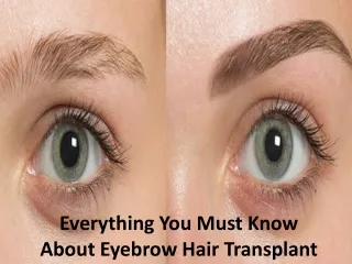 Everything You Must Know About Eyebrow Hair Transplant