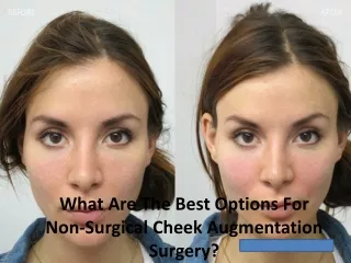 What Are The Best Options For Non-Surgical Cheek Augmentation Surgery?