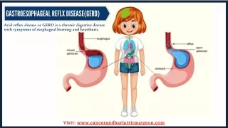 Gastroesophageal Reflux Disease-GERD | Upper GI Cancer Surgeon in Bangalore