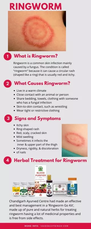 ringworm