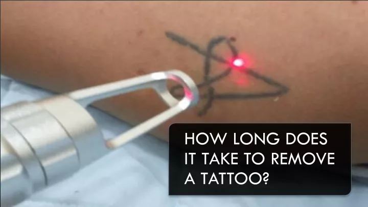 how long does it take to remove a tattoo