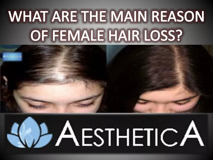 what are the main reason of female hair loss
