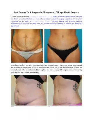 Best Tummy Tuck Surgeon in Chicago and Chicago Plastic Surgery