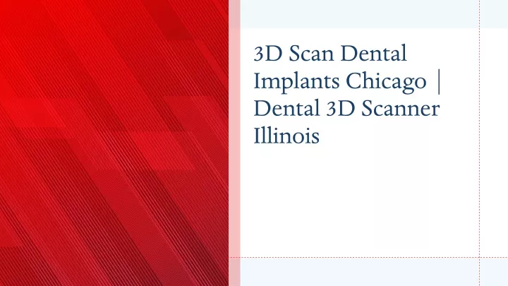 3d scan dental implants chicago dental 3d scanner illinois