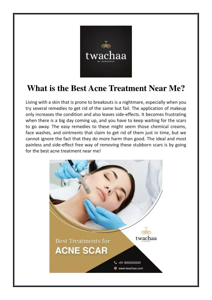 what is the best acne treatment near me