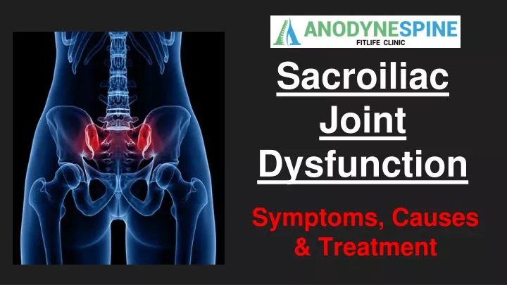 sacroiliac joint dysfunction