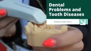Dental Problems and Tooth Diseases