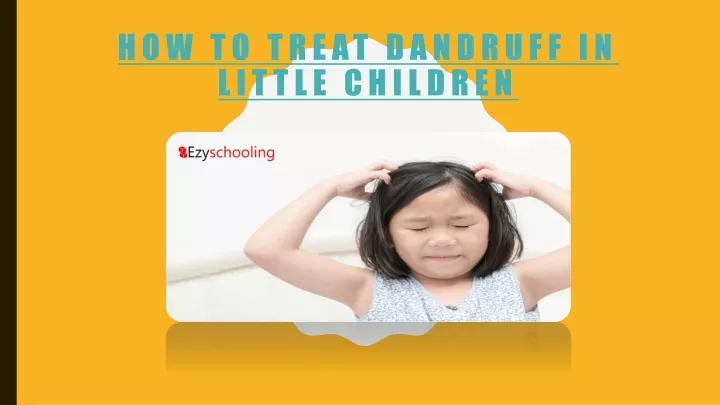 how to treat dandruff in little children