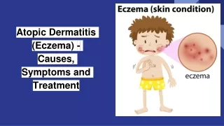 Atopic Dermatitis Symptoms and How to Contact for Dermatitis Treatment Online