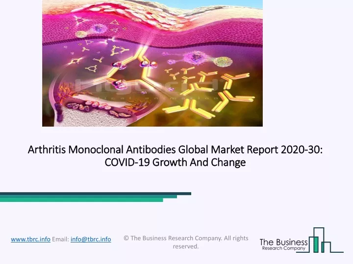 arthritis monoclonal antibodies global market report 2020 30 covid 19 growth and change
