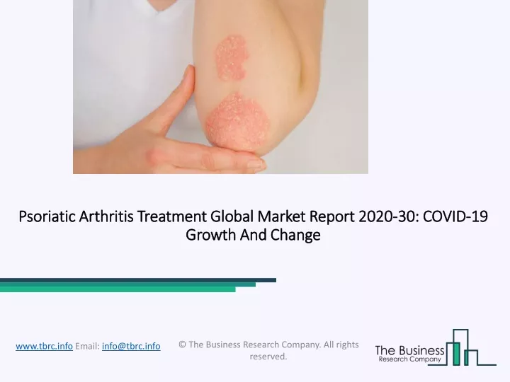psoriatic arthritis treatment global market report 2020 30 covid 19 growth and change