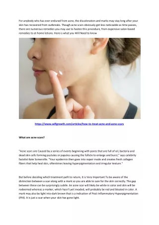 for anybody who has ever endured from acne