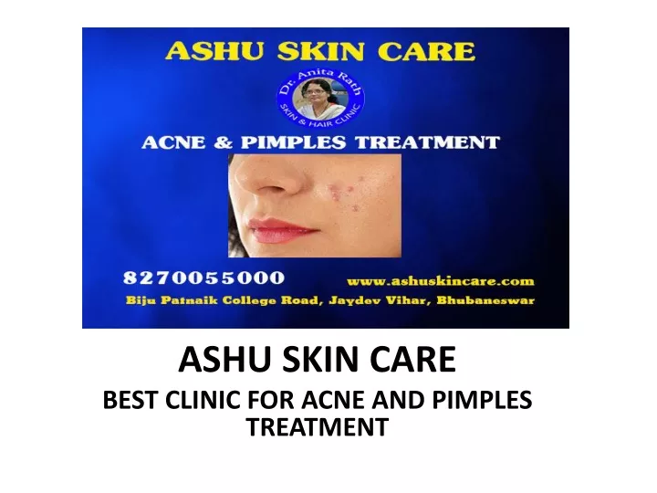ashu skin care best clinic for acne and pimples treatment