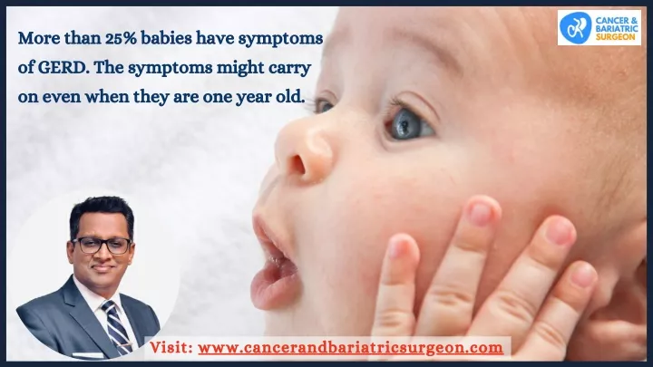 more than 25 babies have symptoms of gerd
